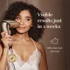 Epiliatorius Silk'n IPL 7 Hair Removal Gold SEV1PE1CC001