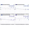 Laidas MMCX – RP-SMA / ACMMCXRPSMA MikroTik