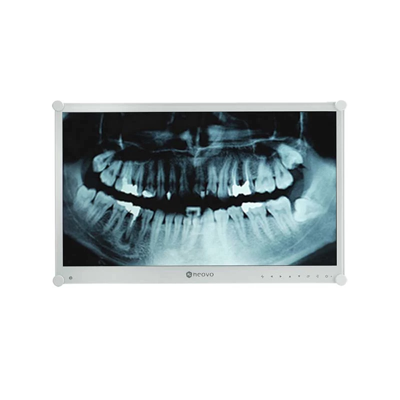 AG Neovo DR-24G 23,8 colių Full HD LCD monitorius odontologijai, baltas