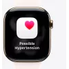 Išmanusis laikrodis Apple Watch Ultra 3 GPS + Cellular 49mm Juodo titano korpusas su Juodu Alpine Loop dirželiu (M)
