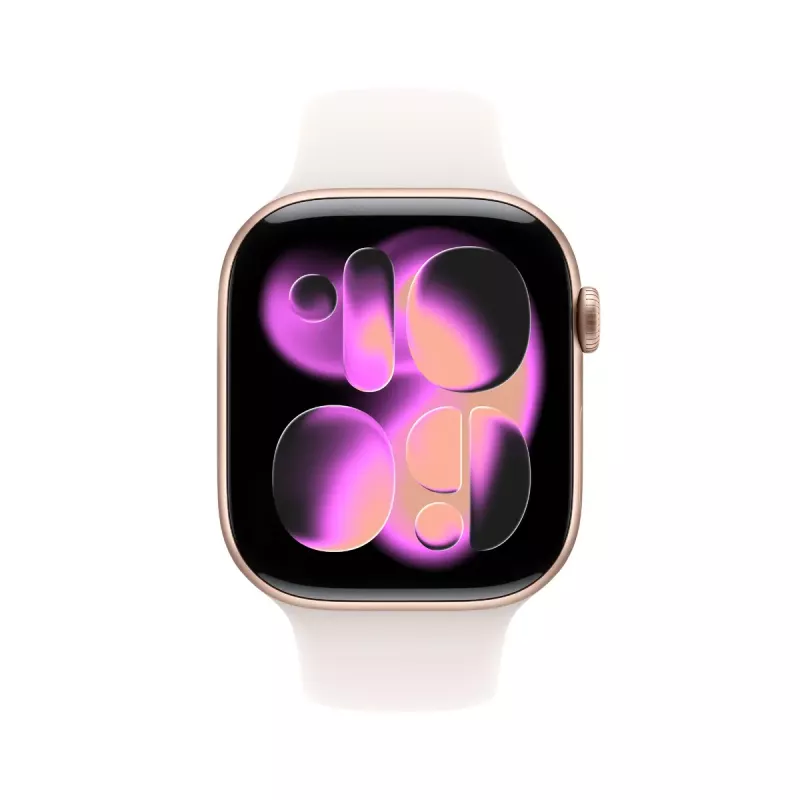 Išmanusis laikrodis Apple Watch Series 11 GPS + Cellular 46 mm rožinio aukso aliuminio korpusas, šviesiai rausvas sportinis dirželis M/L