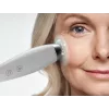 HoMedics MD-1000-EU2 odos priežiūros prietaisas Vakuuminė mikrodermabrazija Baltas