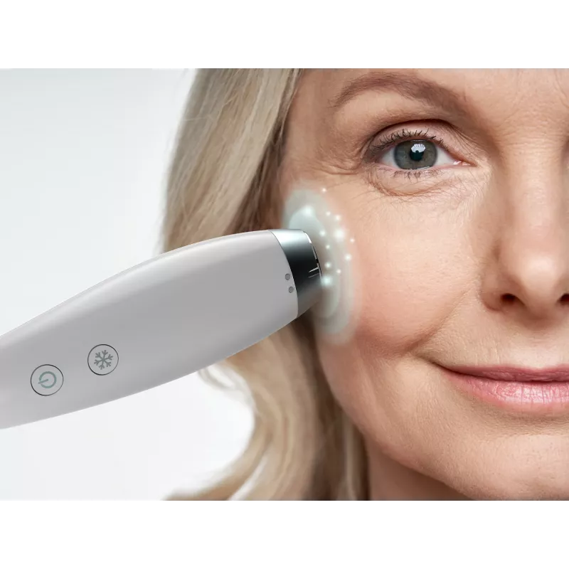 HoMedics MD-1000-EU2 odos priežiūros prietaisas Vakuuminė mikrodermabrazija Baltas