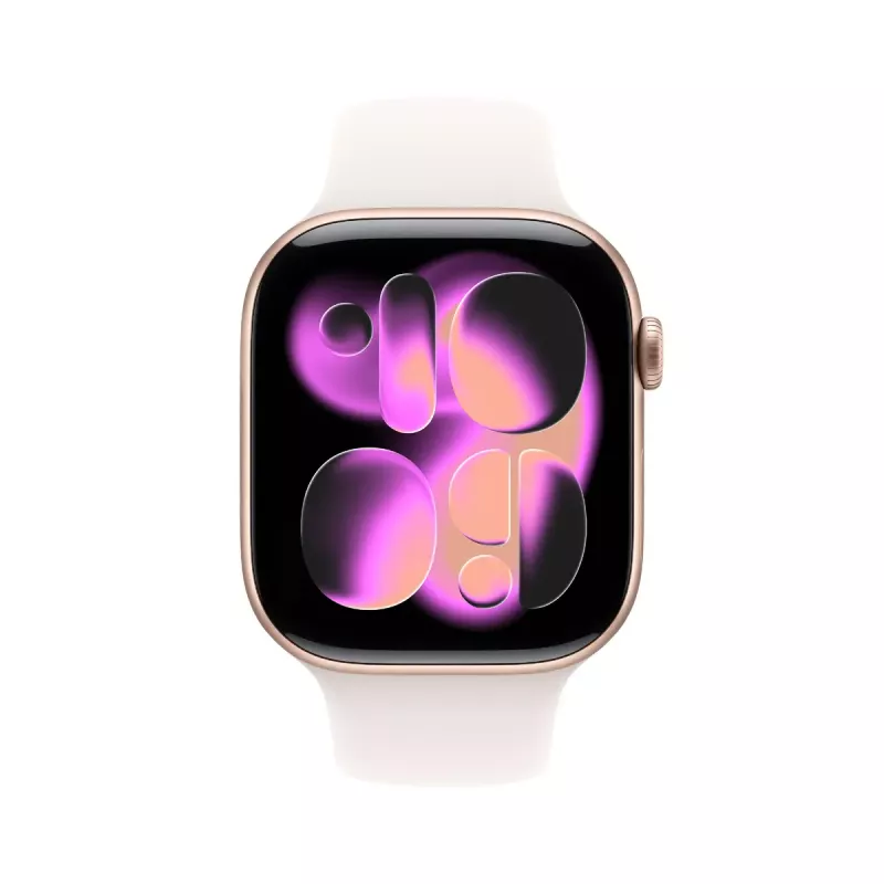 Apple Watch Series 11 GPS 46mm rožinio aukso aliuminio korpusas su šviesiai rožiniu sportiniu dirželiu S/M