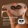 Silk'n LED Face Mask Pro FLMP1PE1001 – LED veido kaukė nuo senėjimo ir spuogų